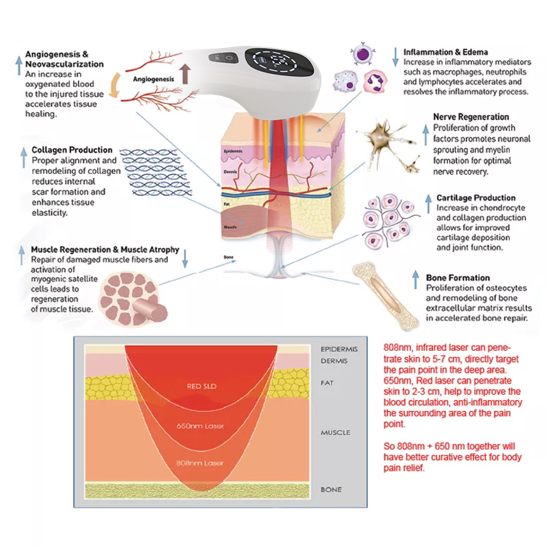 2x808nm Cold Laser Therapy Dev - Badminton Bag recension och pris